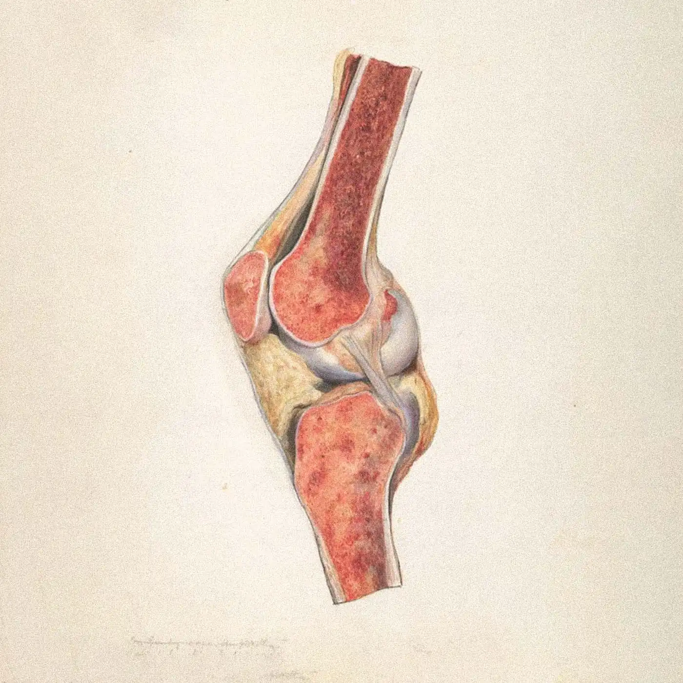 Anatomical illustration of a knee joint and ligaments